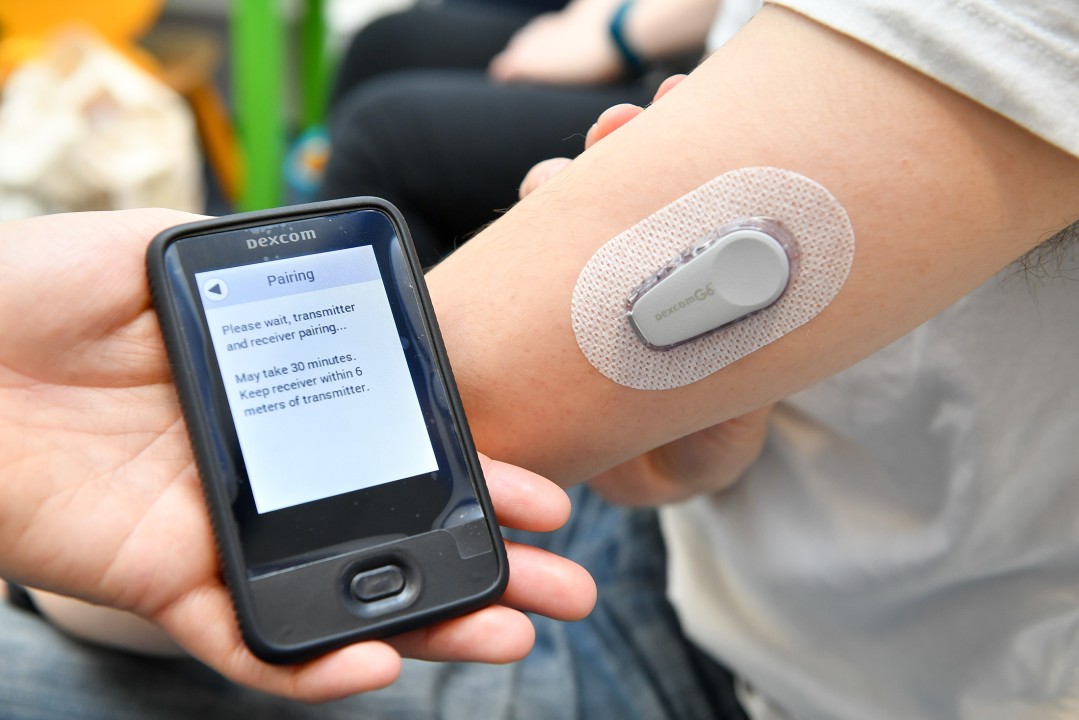 Technology and Affordability in Diabetes