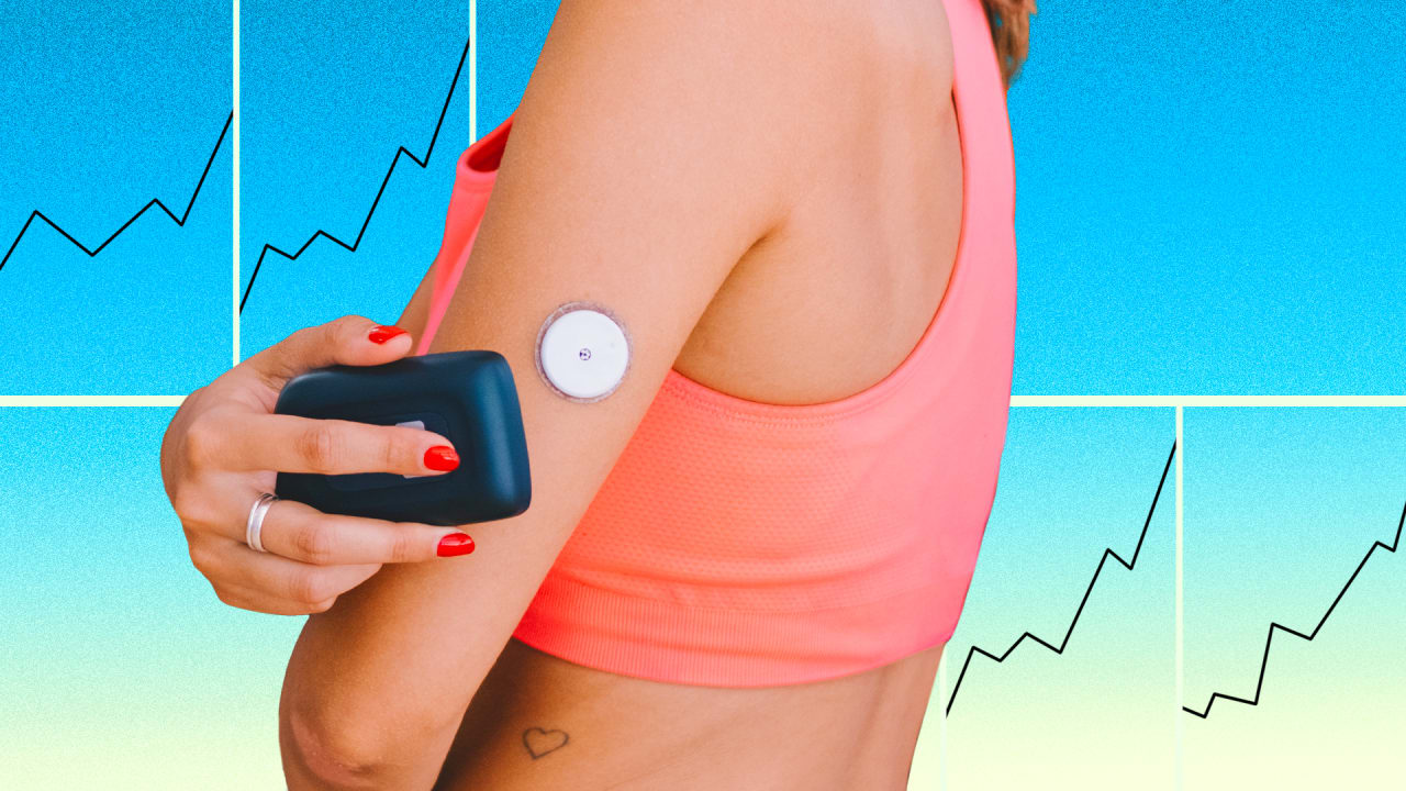 Miniature Continuous Glucose Monitor Leads Diabetes Management Innovation