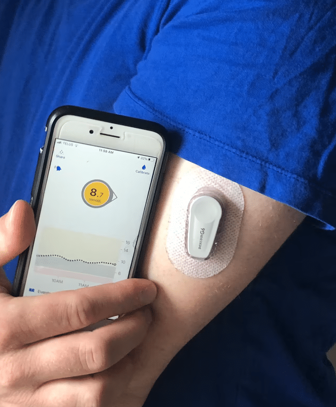 The Rise of CGM Accessibility