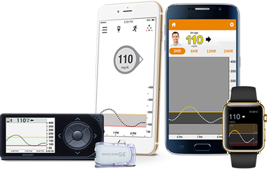 Exploring Dexcom's Insights: Unveiling HCL Systems in Diabetes Management
