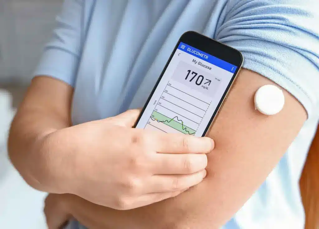 Counter Continuous Glucose Monitor