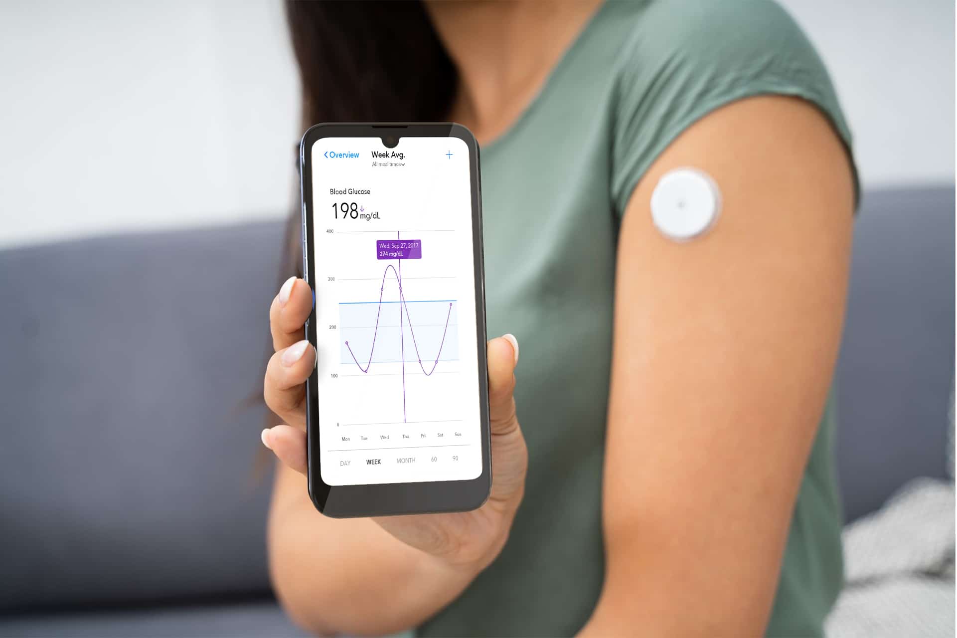 How Does Diabetes Technology Impact Management with CGM?