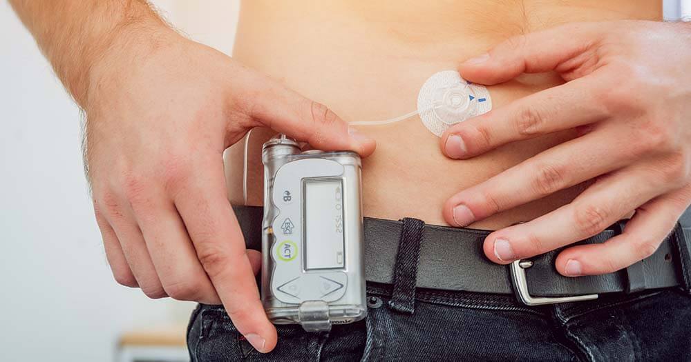 Closed-Loop Systems Transform Glucose Management