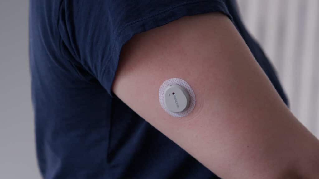 Continuous Glucose Monitors Revolutionize Medical Technology