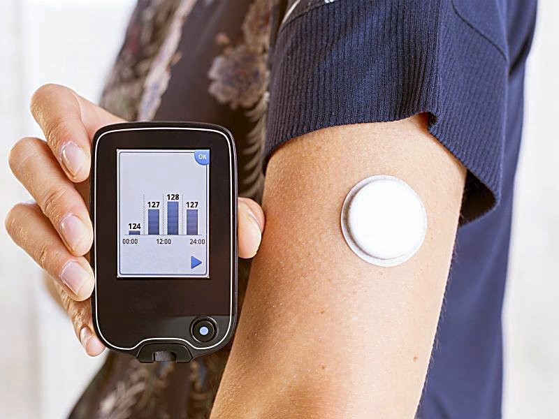 advancements have been made in CGM technology