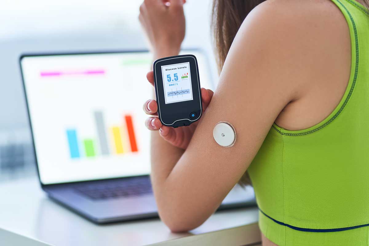 Continuous Glucose Monitors: Wearable Technology Trend