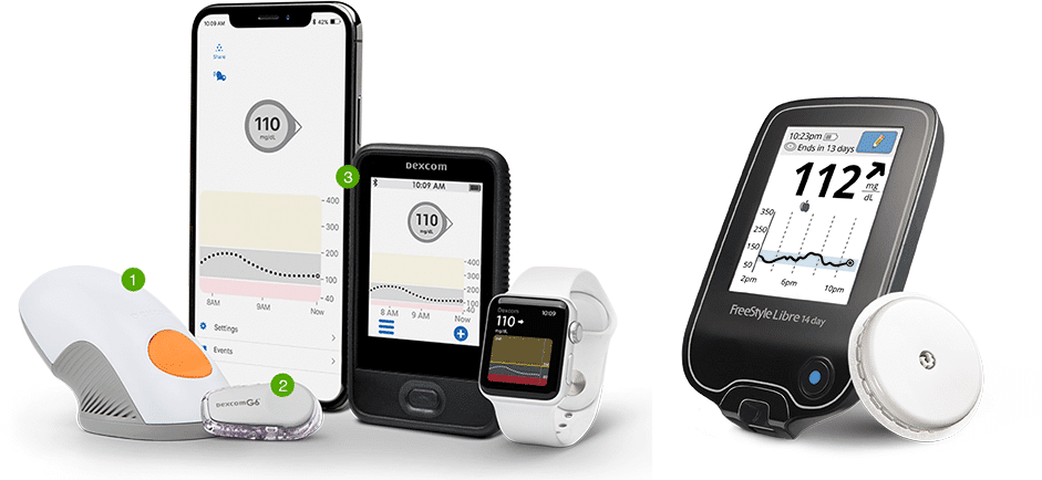 Continuous Glucose Monitors: Revolutionizing Diabetes Management