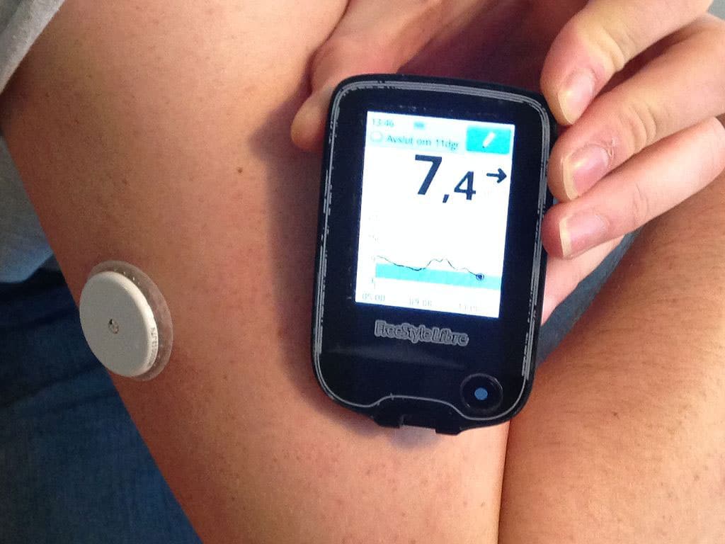 Monitoring Your Blood Sugar with Continuous Glucose Monitors