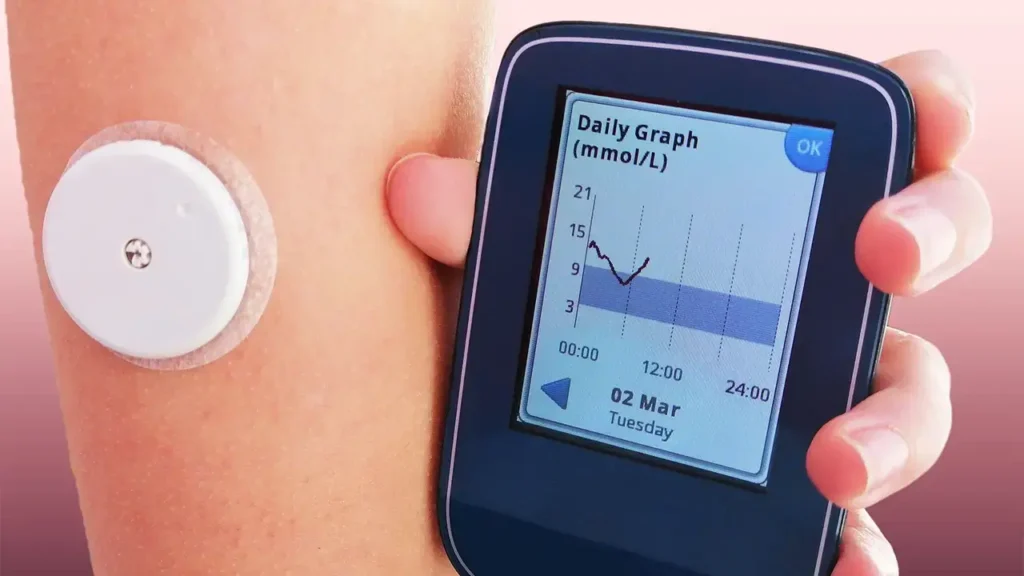 The Evolution of Flash and Continuous Glucose Monitors