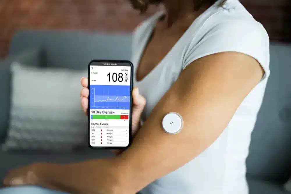 Continuous Glucose Monitoring