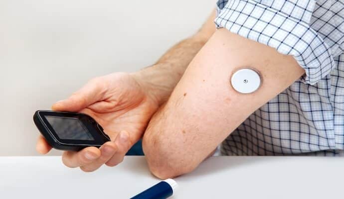 Exploring Interstitial Fluid: The Connection to Continuous Glucose Monitors