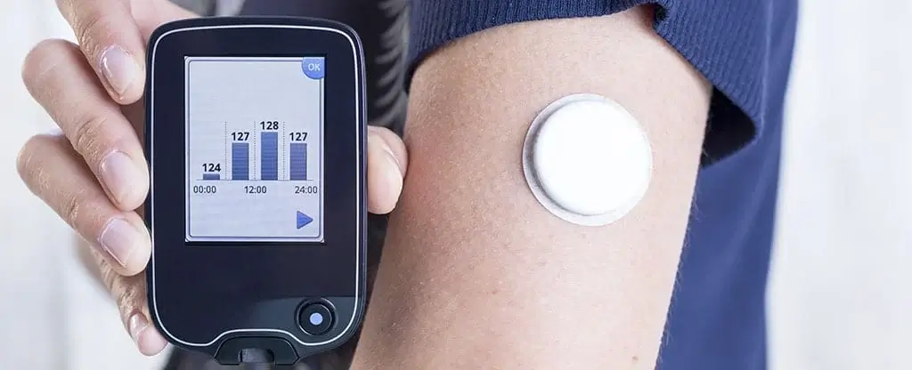 The Inner Workings of Continuous Glucose Monitors CGMs