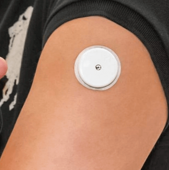 Continuous Glucose Monitors: A Powerful Tool, Not a Normalization of Diabetes