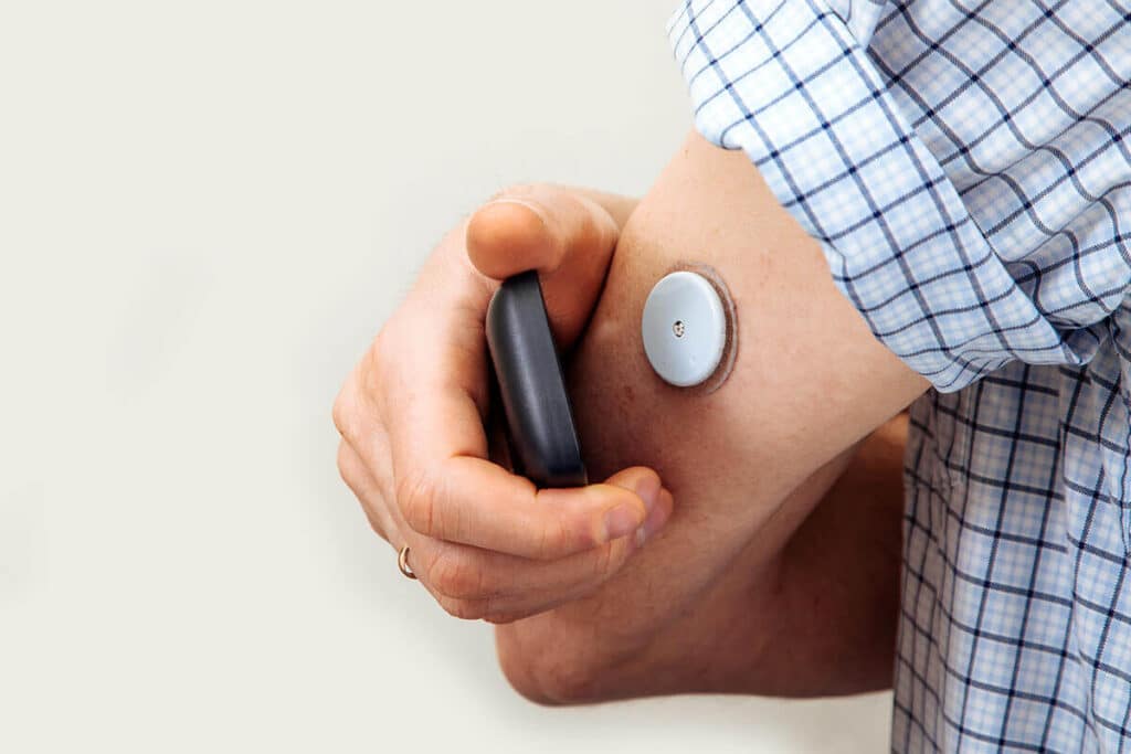 Continuous Glucose Monitoring